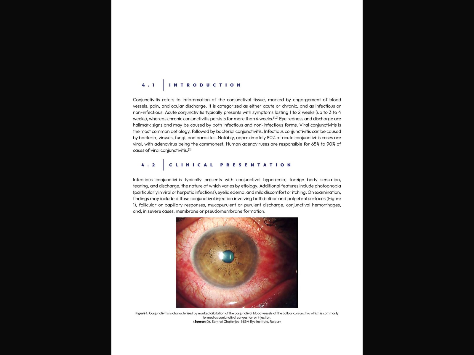 Outbreaks of Infectious Conjunctivitis — a reference volume, built to be navigated rather than filed. — 2