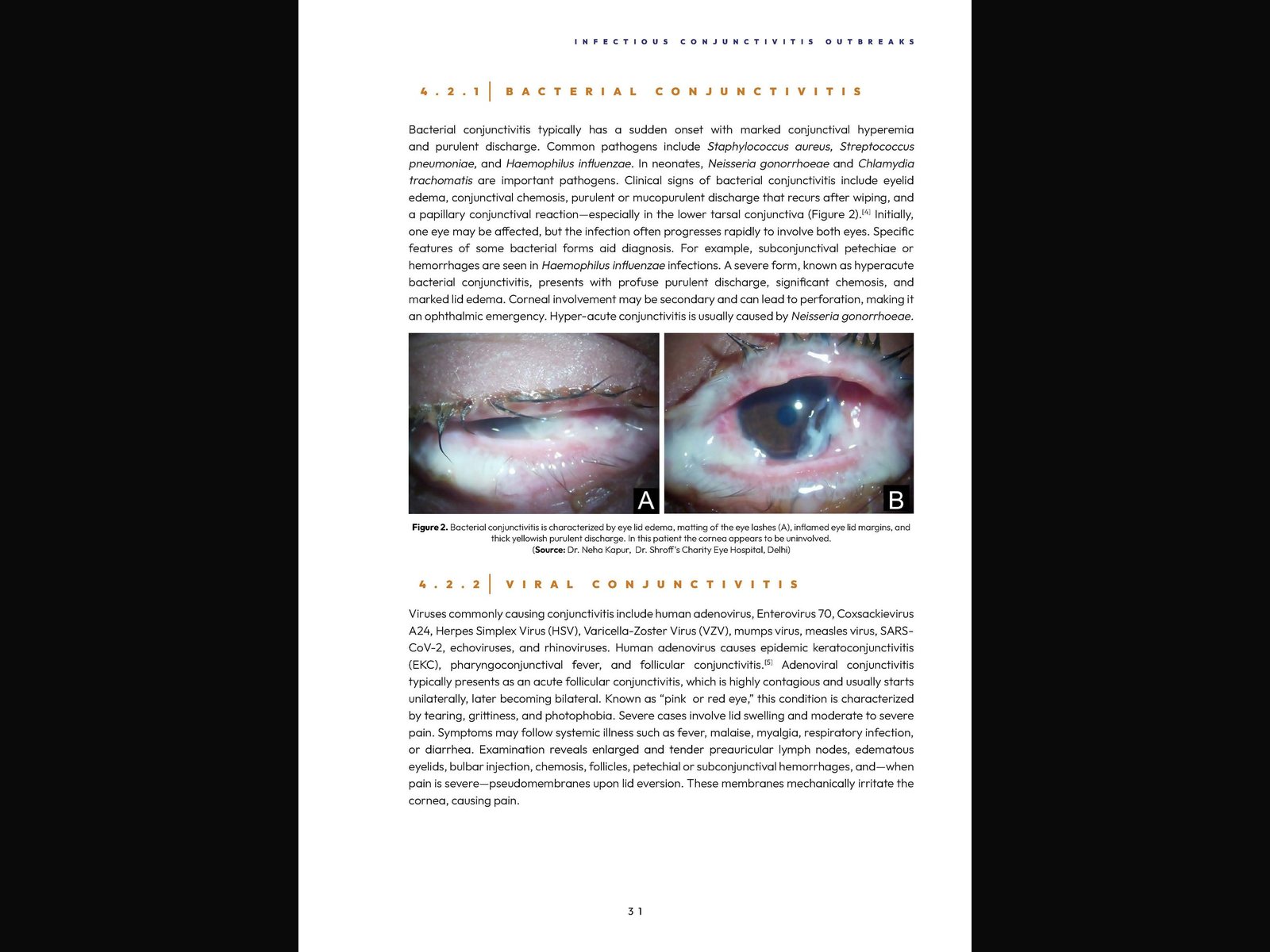 Outbreaks of Infectious Conjunctivitis — a reference volume, built to be navigated rather than filed. — 3